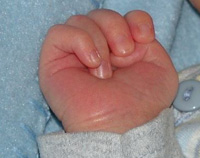 Baby Hand